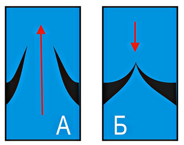 вузли міоми