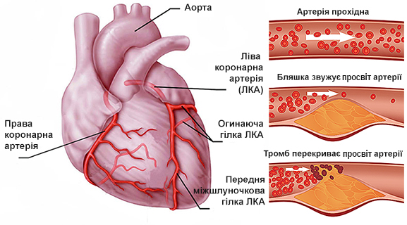 Артерії серця