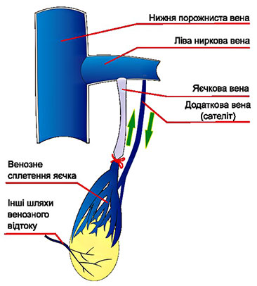 операція Іваніссевича