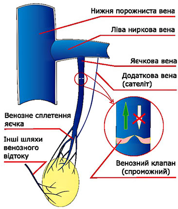 вузли міоми